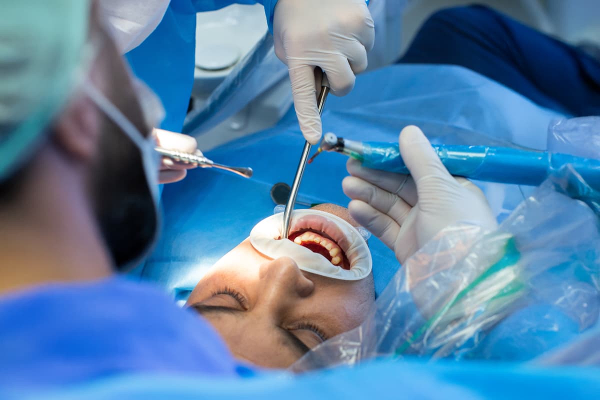 Estrazione dentale