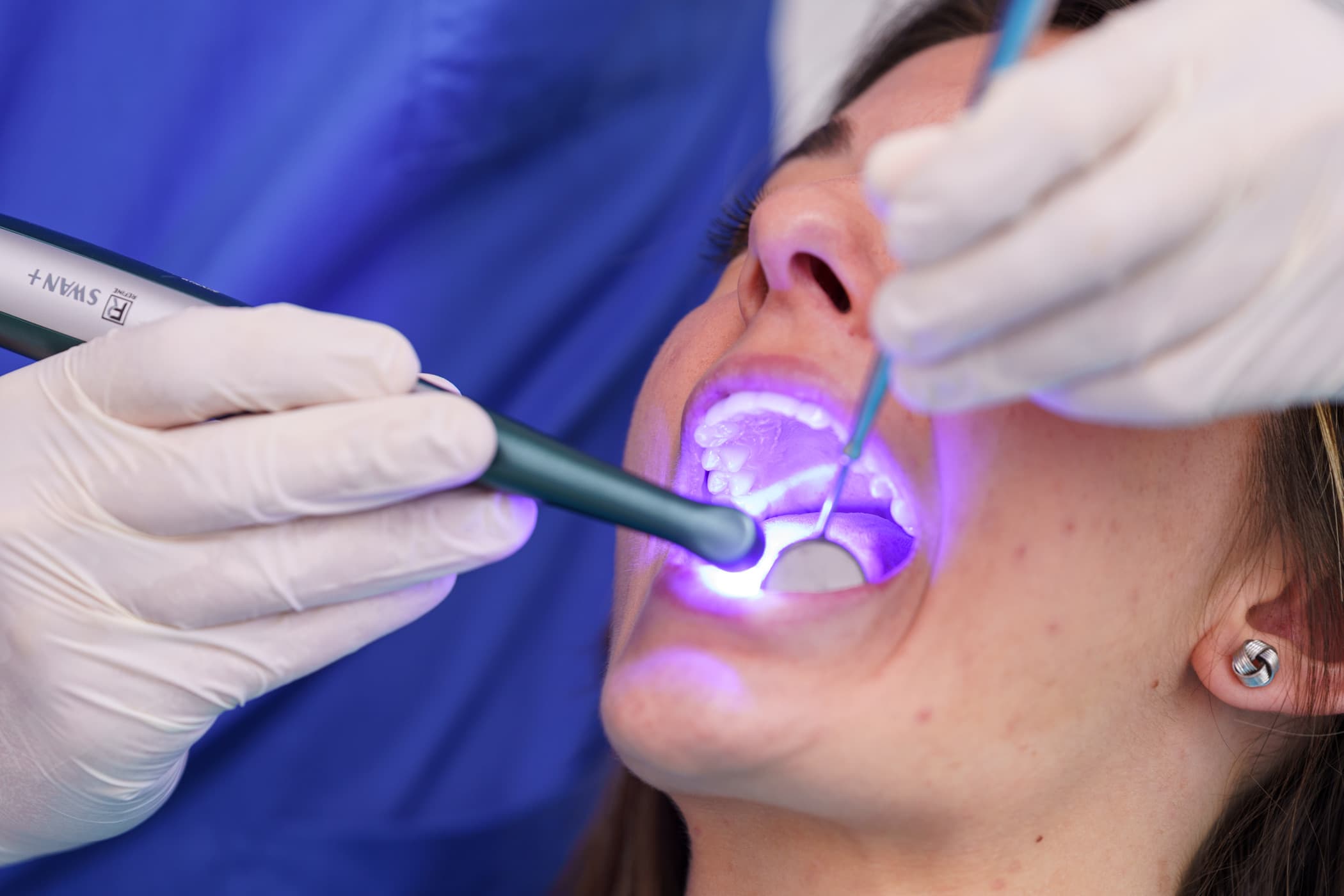 Conservative Dentistry 