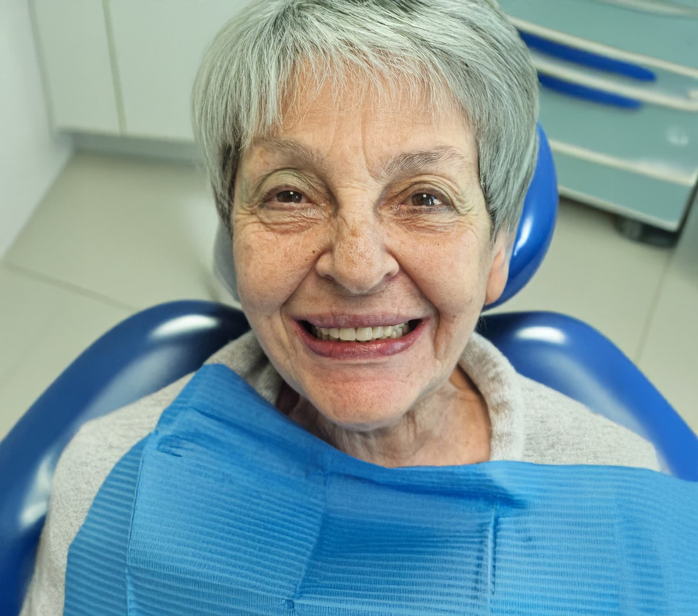 Removable Dental Prostheses 