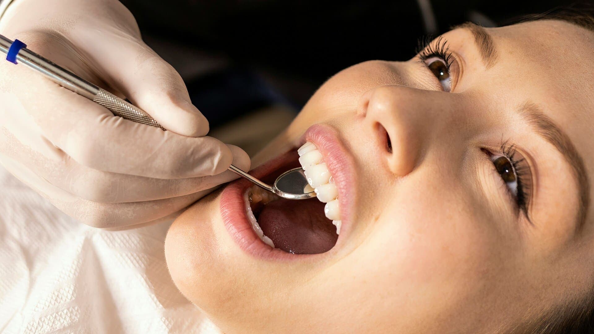 Advanced peri-implantitis